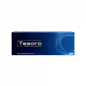 Tesoro Deep lido