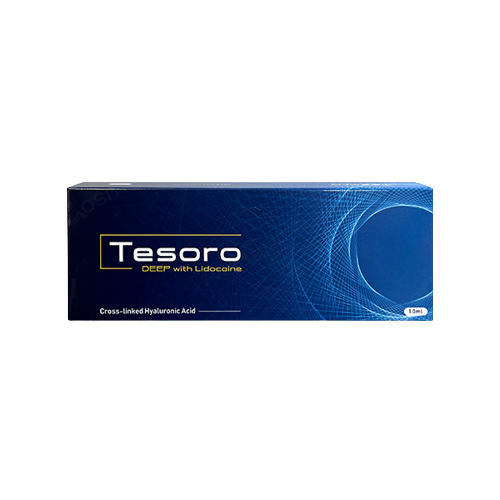 Tesoro Deep lido